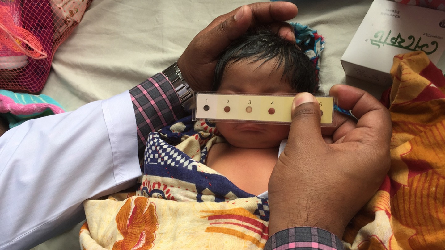 Bili Ruler Bili-ruler Tool for Newborn Jaundice | Global Alliance for Infant and ...